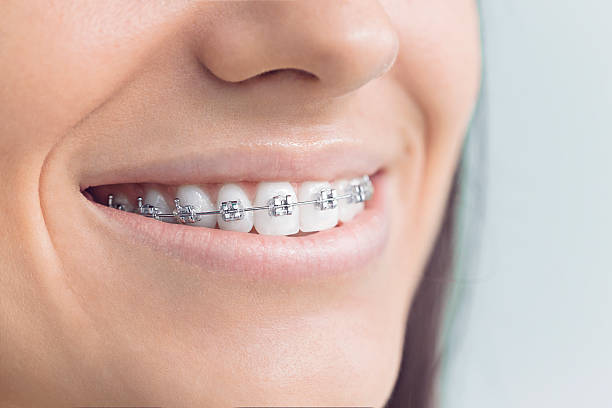 Best Wisdom Tooth Removal  in Mayo, FL